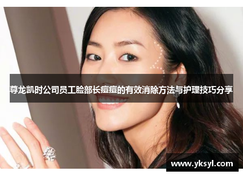 尊龙凯时公司员工脸部长痘痘的有效消除方法与护理技巧分享 尊龙凯时公司员工脸部长痘痘的有效消除方法与护理技巧分享